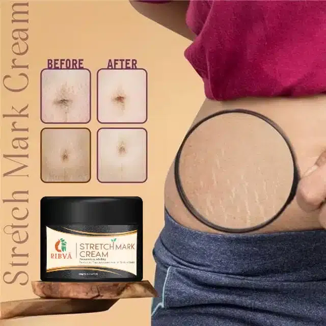 Ribva Stretch Marks Cream (100 g)