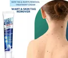 Wart Remover Cream 