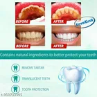 Growkesh Teeth Whitening Foam 