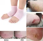 Silicone Gel Heel Pad 