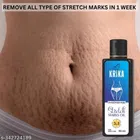 Krika Stretch Mark Removal Oil (50 ml)