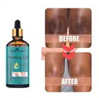 Park Daniel Skin Peeling Herbal Oil 