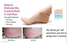 Silicone Pain Relief Heel Socks for Unisex 