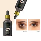 Under Eye Serum (30 ml)