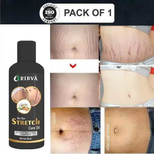 Ribva Stretch Marks Oil (50 ml)