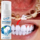 Growkesh Teeth Whitening Foam 