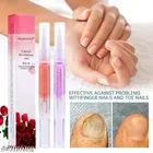 Cuticle Oil Pen Cuticle Revitalizer Oil Pen Nail Cuticle Oil Pen Foot Hand Nail Repair Cuticle Revitalizer Oil Nail Manicure Soften Pen Nail Polish Repair Pen