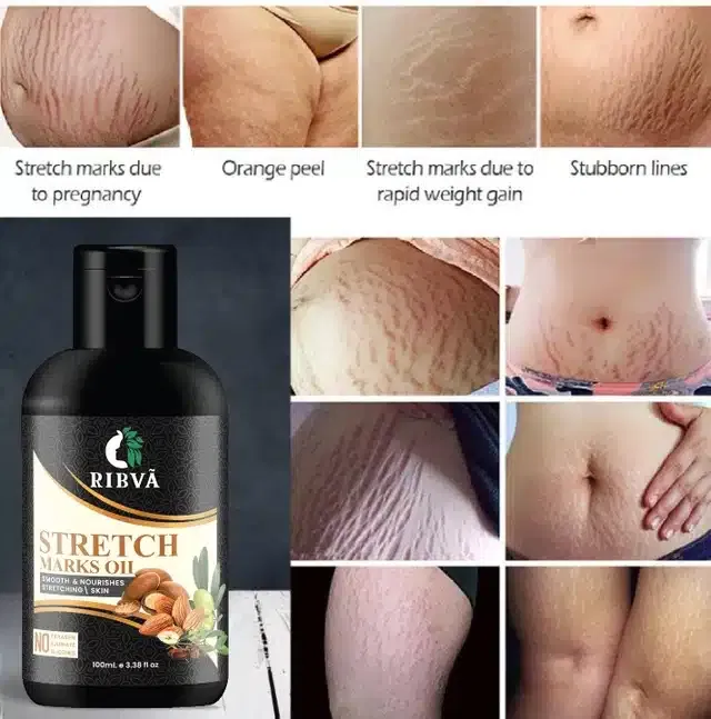 Ribva Stretch Marks Removal Oil (100 ml)