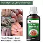Vedulekha Nail Fungus Treatment Oil 