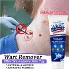 Wart Remover Cream, Massa Removal Cream 