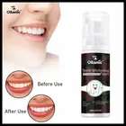 Oilanic Teeth Whitening Foam 