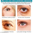 Eye Cream for Dark Circle Remover Cream Wrinkles Removal Cream For Women and Men 100 g